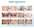 New 7 In 1 Smart Ice Blue Hydra Oxygen Facial, Skin Cleaning, Skin Analyzer, and Dermabrasion