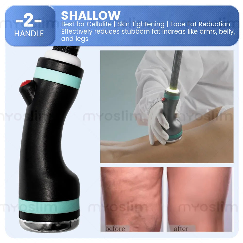 Cellulite Removal Lipolysis Machine, Cool Wave Body Slimming Weight Loss Equipment for Fitness And Wellness